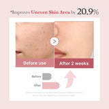 Medicube PDRN Pink Exosome Shot Serum 7500 (30ml) - Kiyoko Beauty
