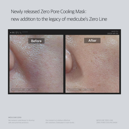 Medicube Zero Pore Cooling Mask (1pc)