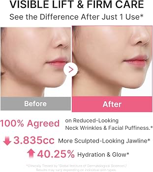 Medicube PDRN Collagen Gua Sha Neck Wrinkle Cream (90g) - Kiyoko Beauty