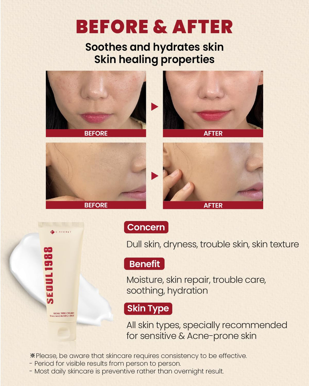 KSECRET SEOUL 1988 Cream: Snail Mucin 93% + Rice (100ml) - Kiyoko Beauty