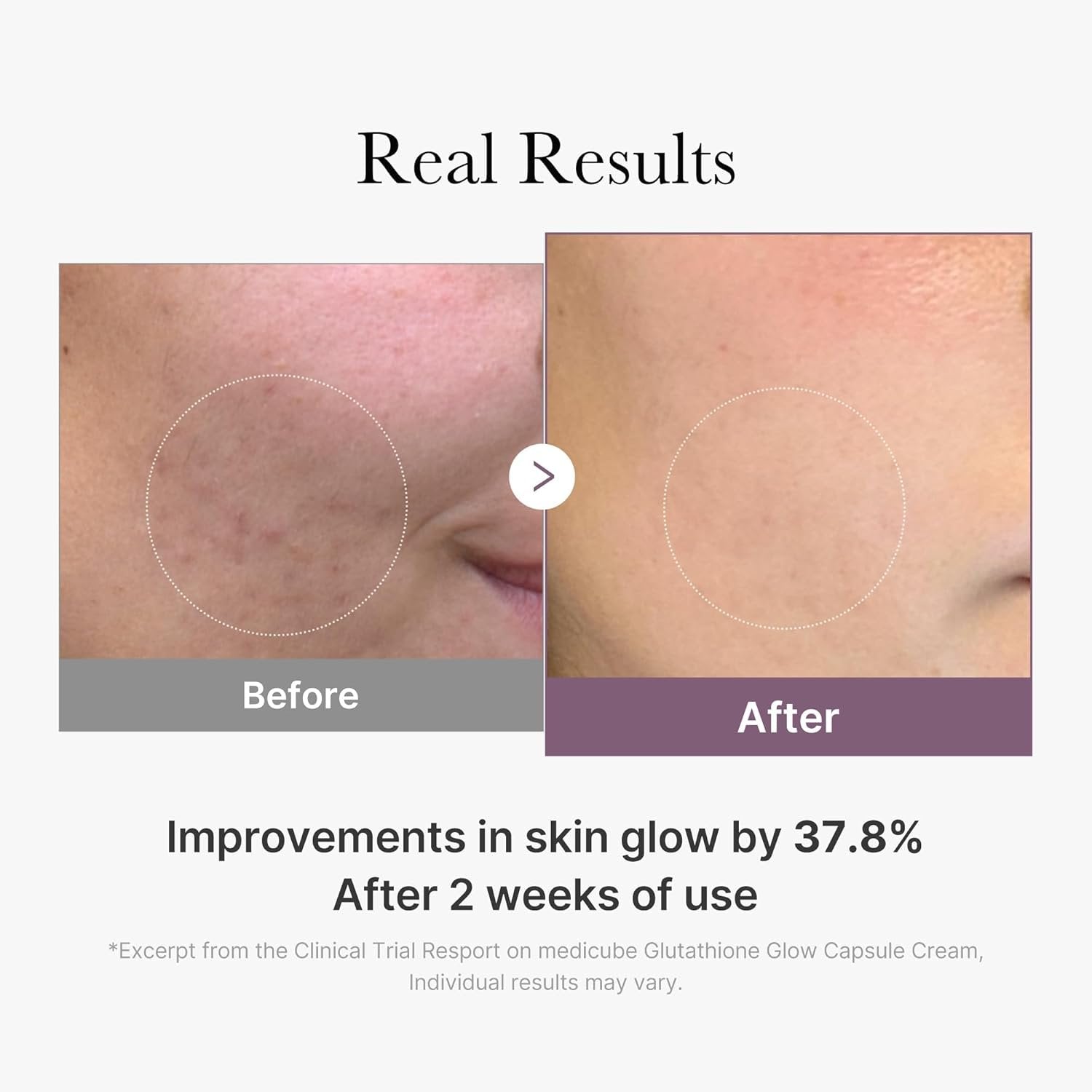 Medicube Age-R Glutathione Glow Cream | Kiyoko Beauty