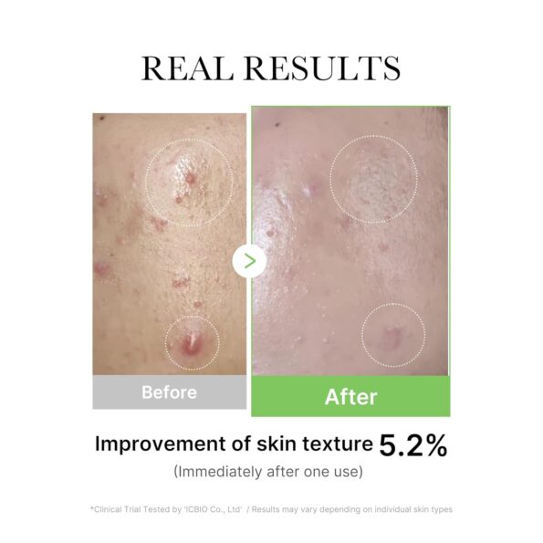 Medicube Exosome Cica Serum (30ml) - Kiyoko Beauty