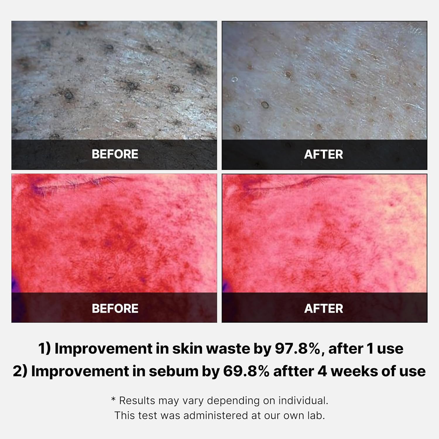 Medicube Red Succinic Acid Peeling Pad (70 PCs) - Kiyoko Beauty