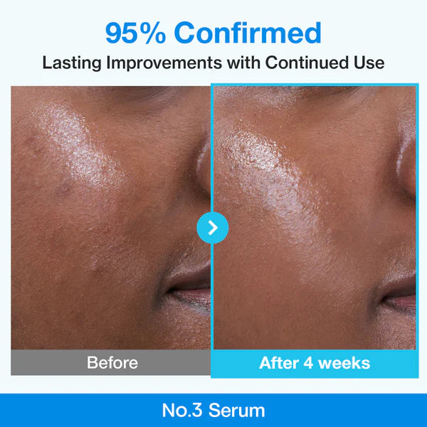 numbuzin No.3 Blue Bio-Retinol Pore Refining Serum