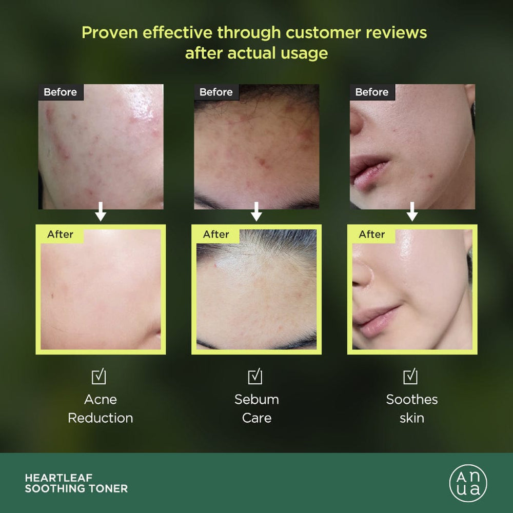 ANUA Heartleaf 77% Soothing Toner (250ml / 40ml) - Kiyoko Beauty