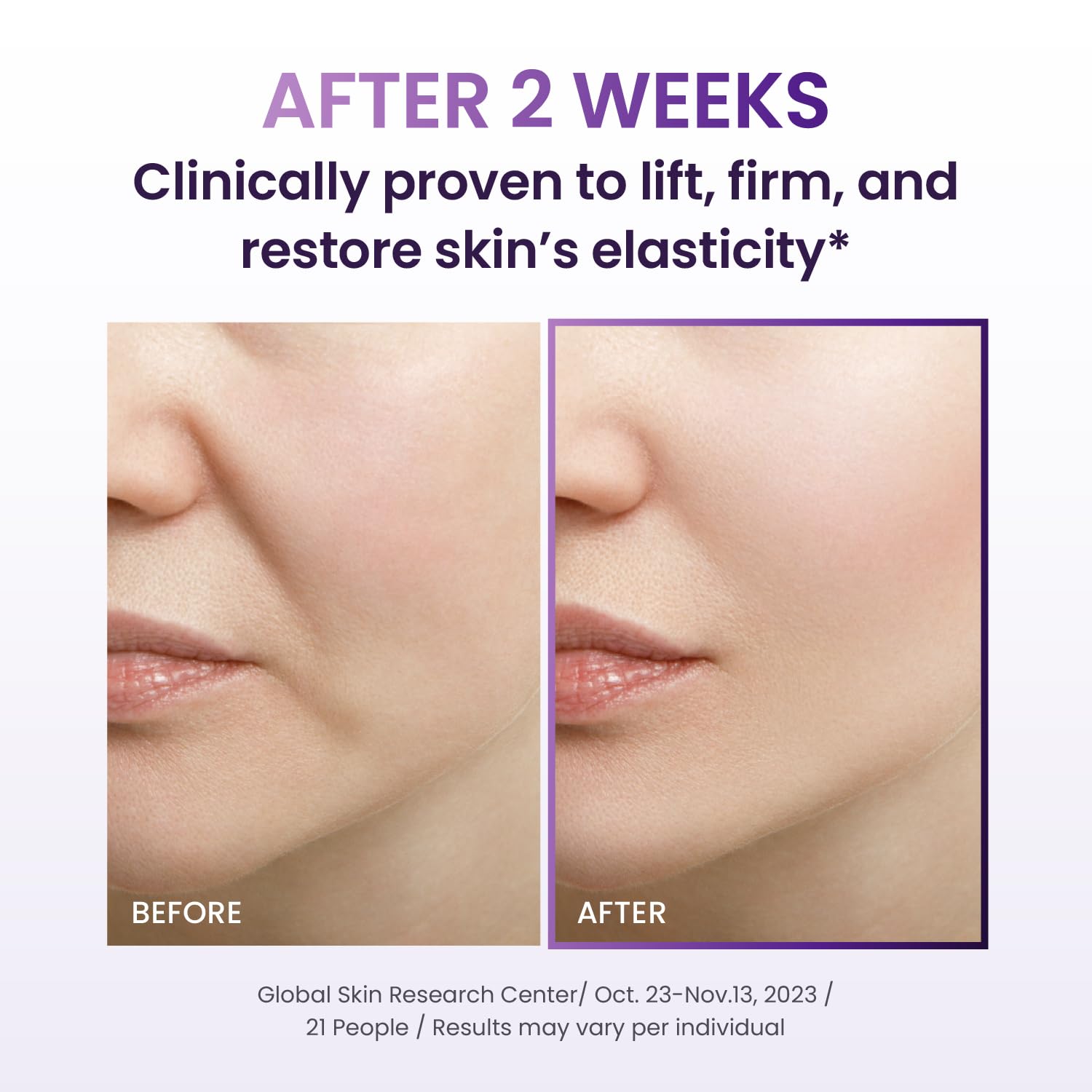 BIOHEAL Probioderm 3D Lifting Cream (50ml)