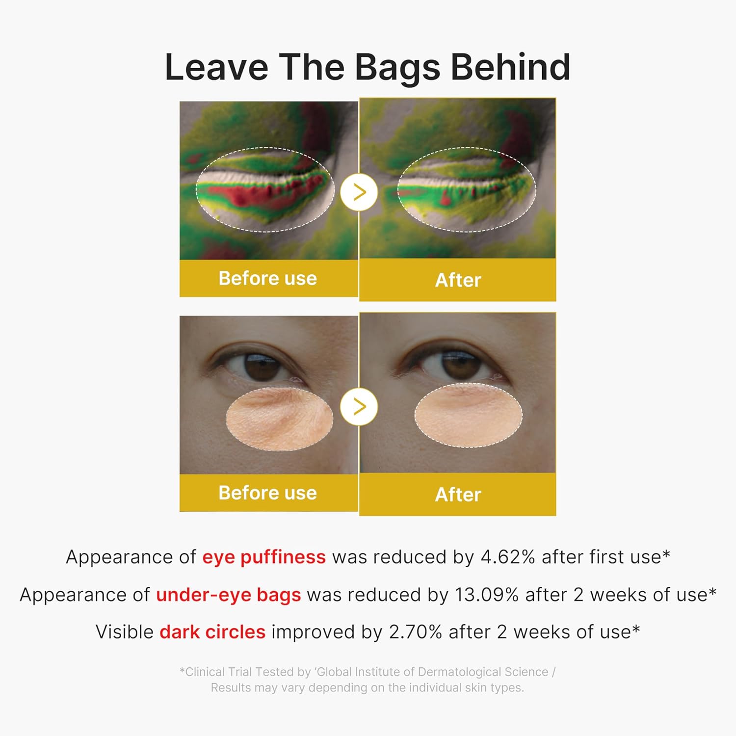 Medicube Kojic Acid Turmeric Vita Eye Gel Serum (30ml)