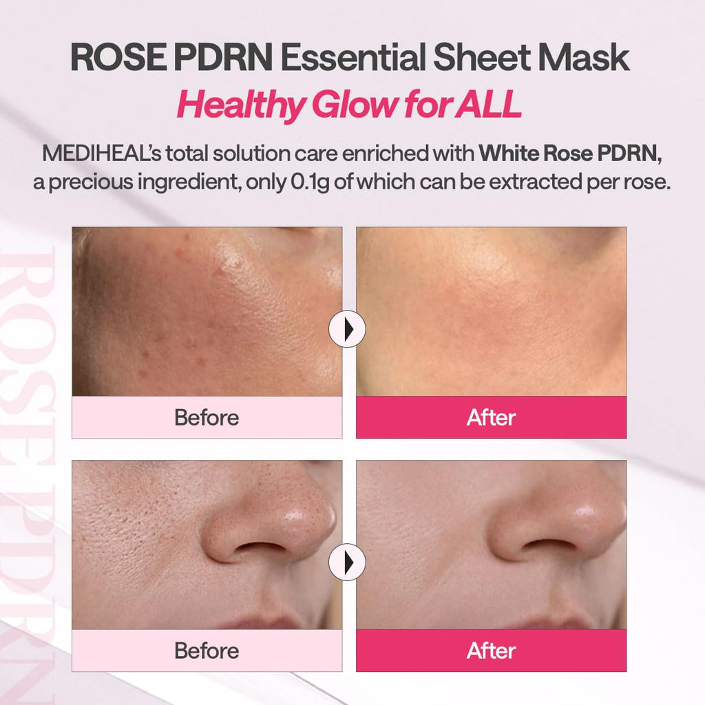 MEDIHEAL Rose PDRN Essential Mask (10 PCs) - Kiyoko Beauty