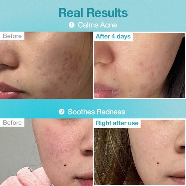 numbuzin No.1 Pantothenic B5 Hyaluronic Active Clear Mask