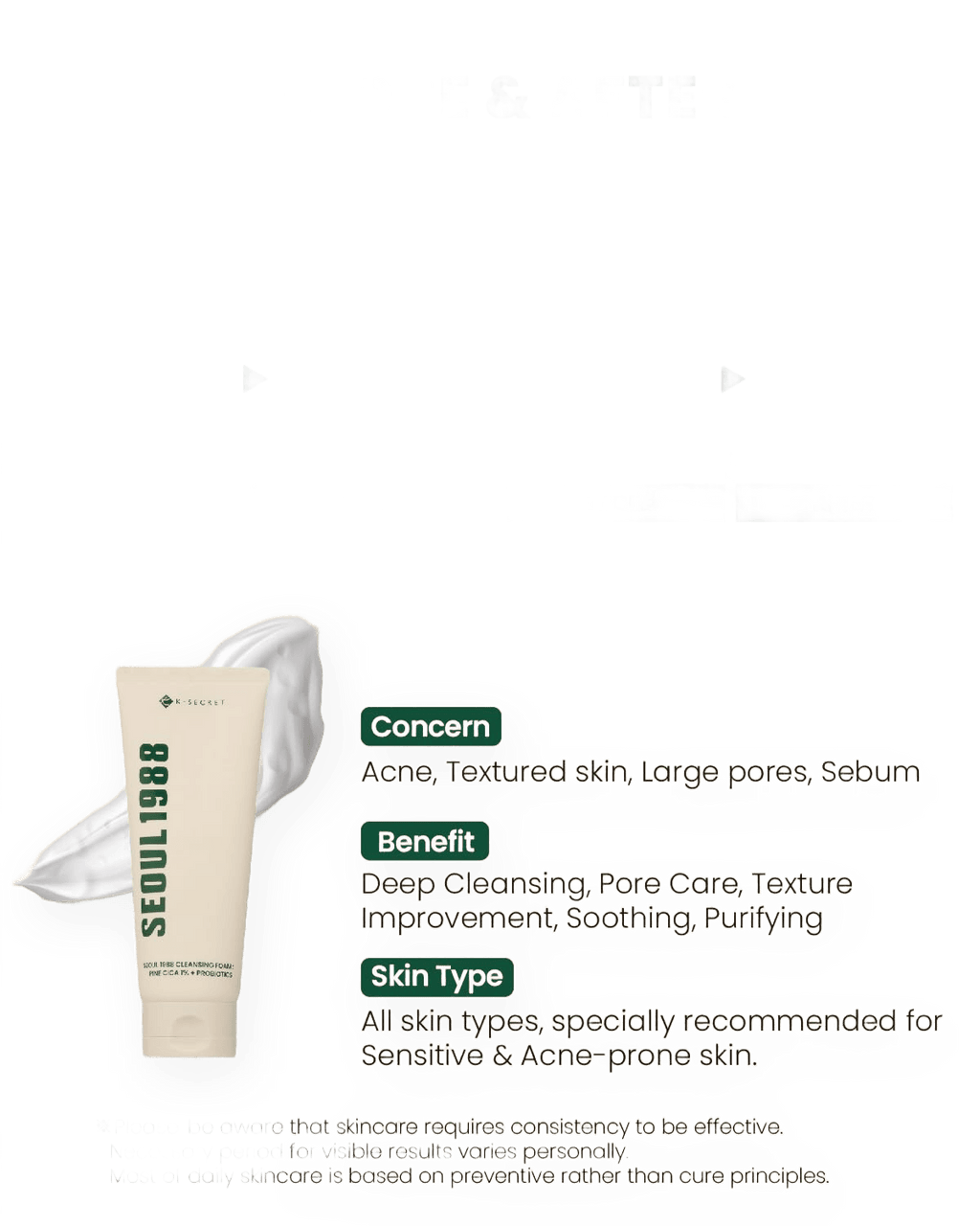 KSECRET SEOUL 1988 Cleansing Foam: Pine Cica 1% + Probiotics (150ml) - Kiyoko Beauty