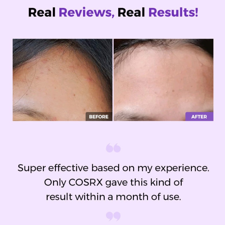 COSRX AHA BHA Clarifying Treatment Toner - Kiyoko Beauty