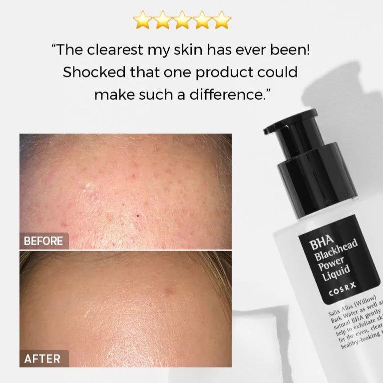 COSRX BHA Blackhead Power Liquid (100ml) - Kiyoko Beauty
